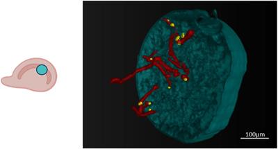 Combining metal nanoparticles and nanobodies to boost the biomedical imaging in neurodegenerative diseases